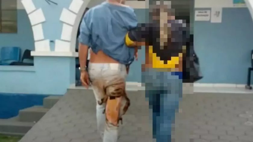 Homem que jogou gasolina na esposa e ateou fogo é condenado a 24 anos de prisão