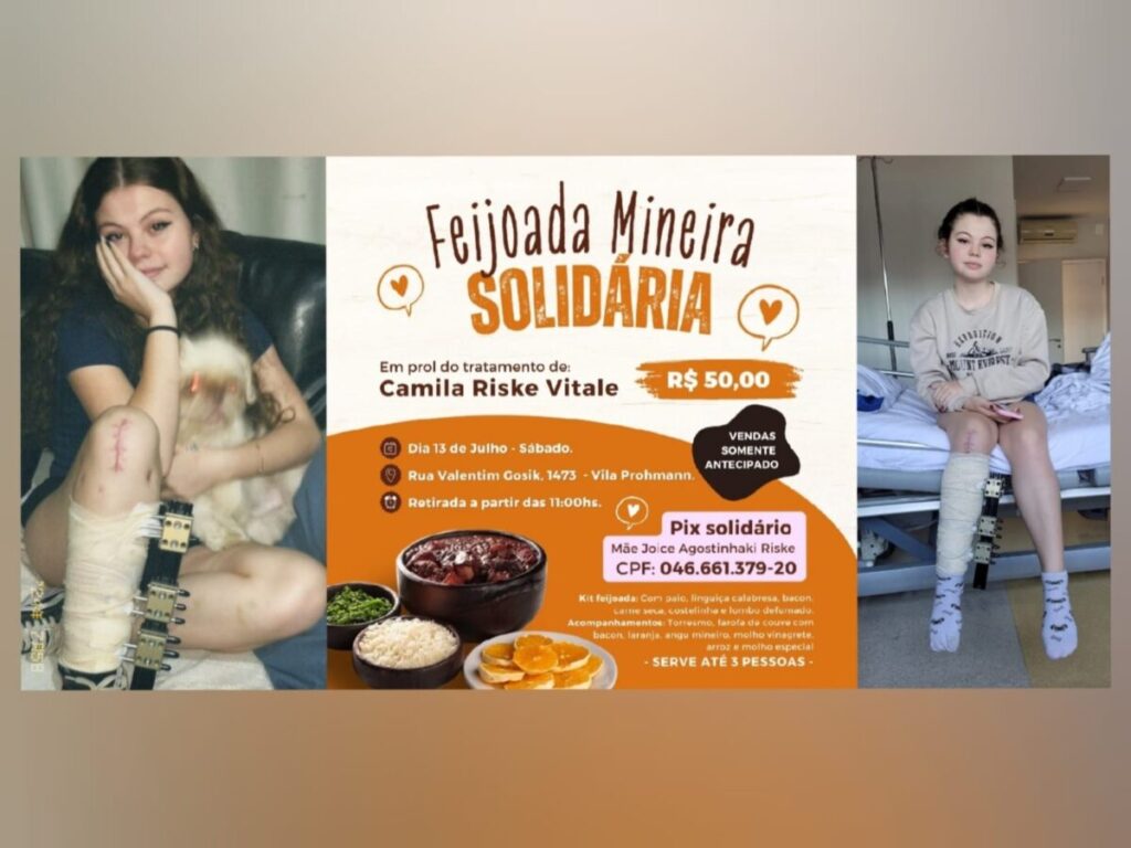 Feijoada Solidária em prol do tratamento de Camila Riske Vitale, de 14 anos, será neste sábado