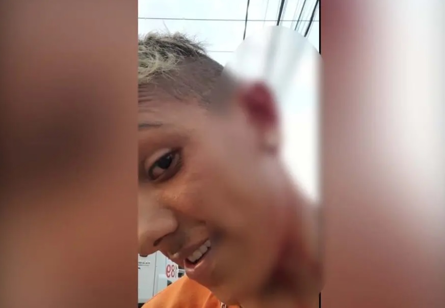 No Paraná, morador agride e rasga orelha de gari após saco de lixo se romper 