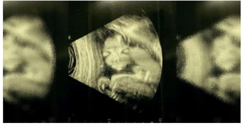 Mulher fica apavorada com ultrassom do próprio bebê: “Criança demônio”