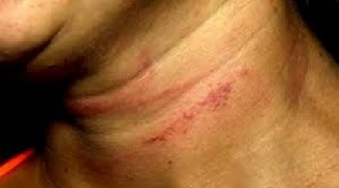 Homem tenta esganar mulher e  ameaça matar a vítima com facão