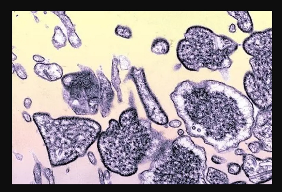 Saiba os sintomas e como se prevenir do vírus Nipah, que pode causar próxima pandemia