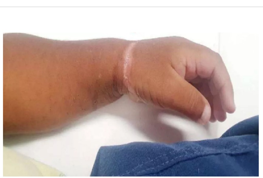 Casal é preso por maus-tratos à bebê de três meses