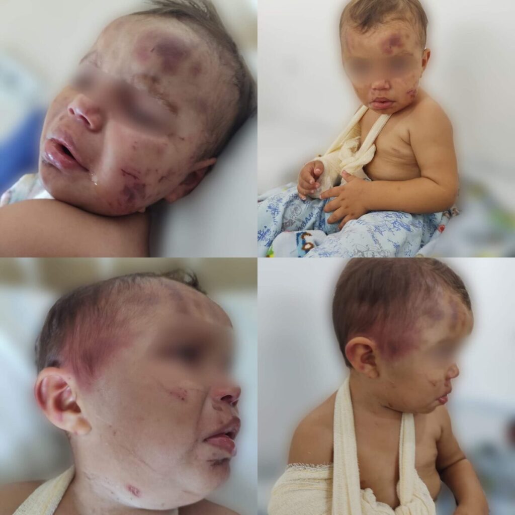 Mãe e padrasto que agrediram criança em Prudentópolis responderão processo em liberdade