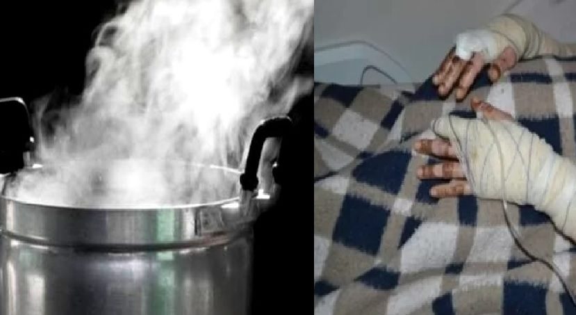 Mulher joga água fervendo no marido e no filho de 3 anos