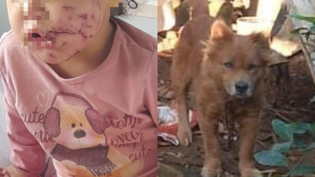 Cachorro invade quintal de residência e ataca gravemente criança de 1 ano e 8 meses