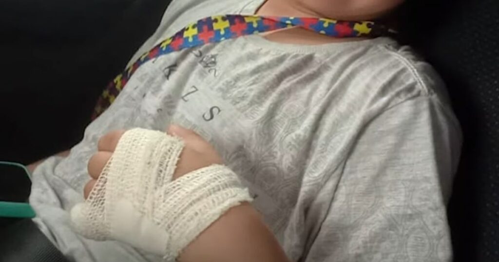 Menino autista perde parte do dedo após ir ao banheiro na escola
