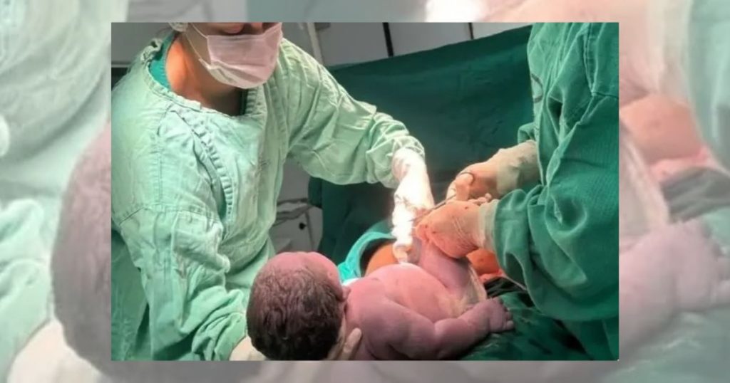 Bebê gigante quebra recorde e nasce com 6,2 kg em Minas Gerais
