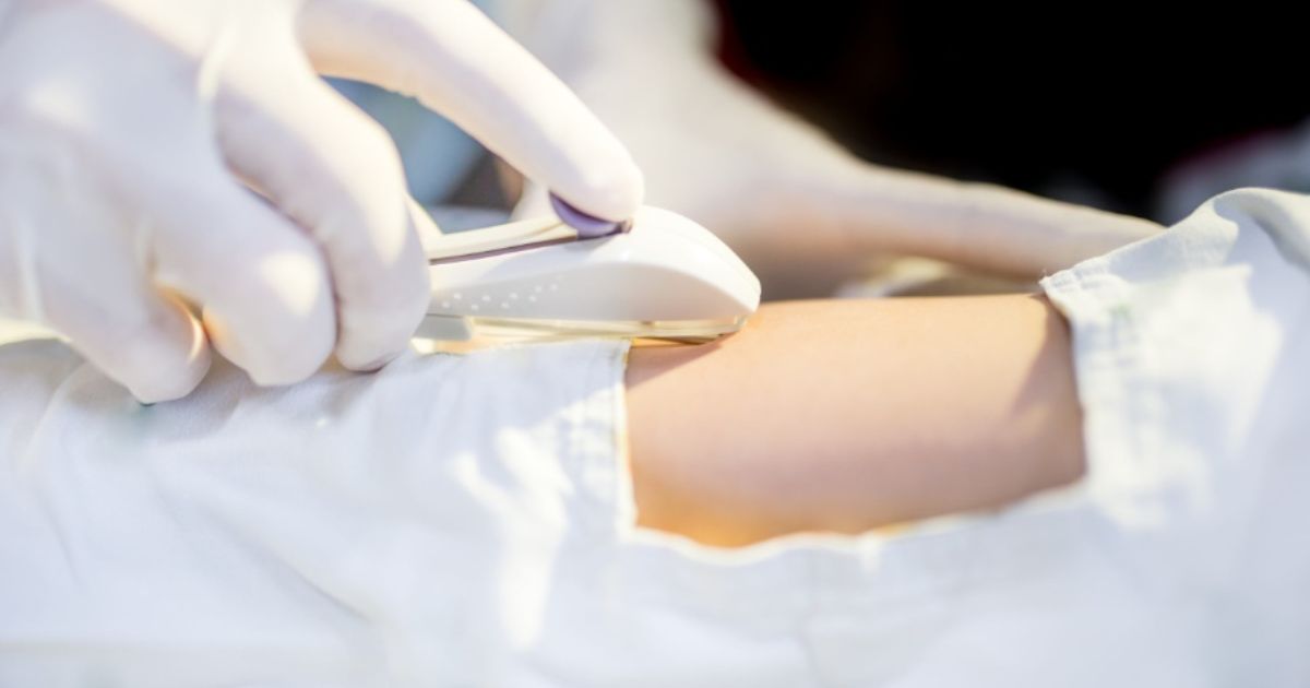 Implante contraceptivo hormonal será oferecido pelo SUS