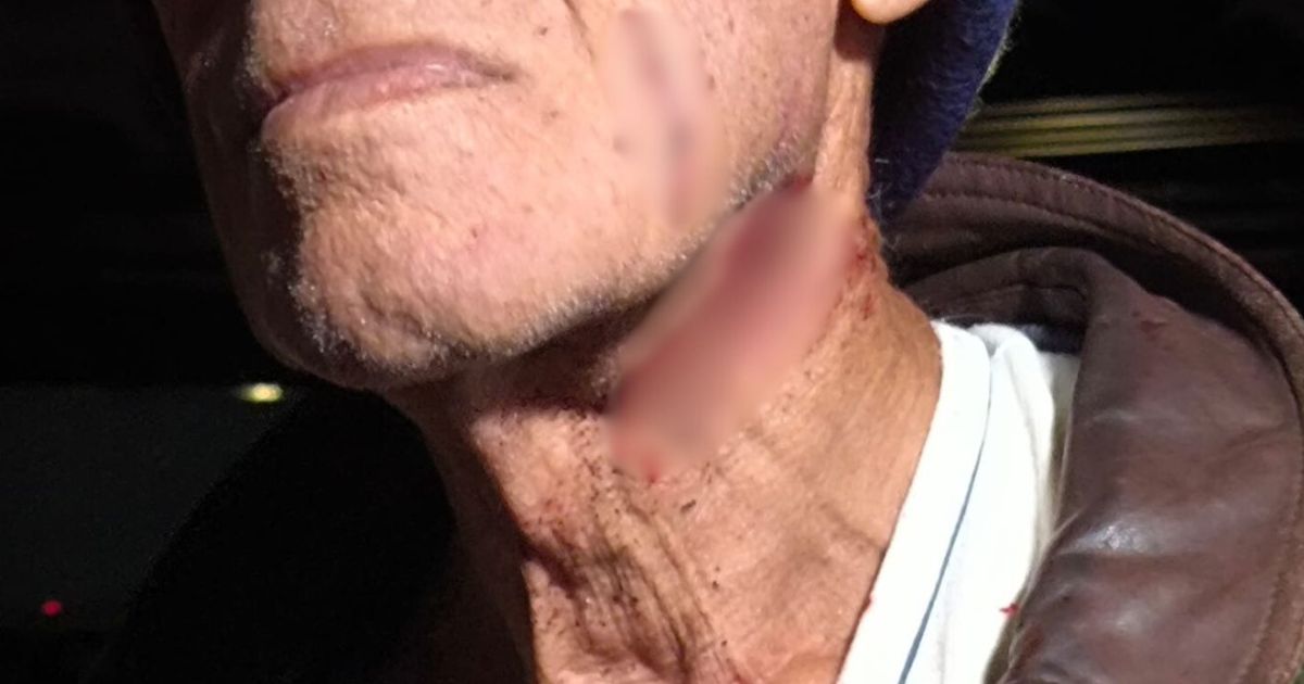 Idoso é agredido com guarda-chuva por vizinha enquanto varria calçada no Paraná