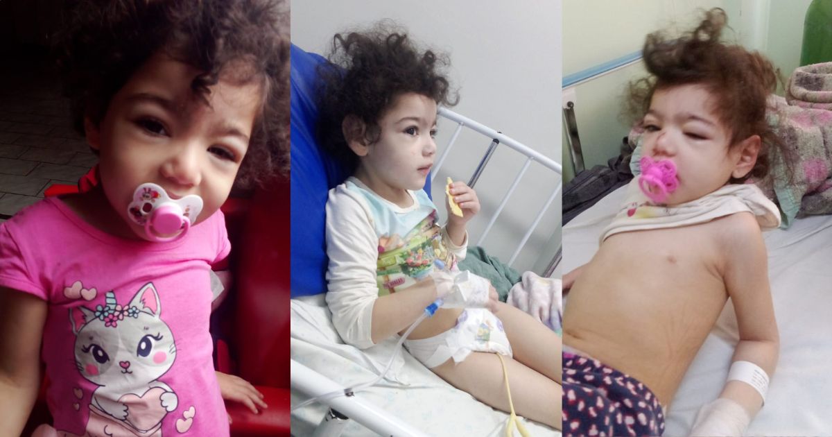 Família de São João do Triunfo pede ajuda para tratamento de Marília, criança de 3 anos com microcefalia e síndrome nefrótica