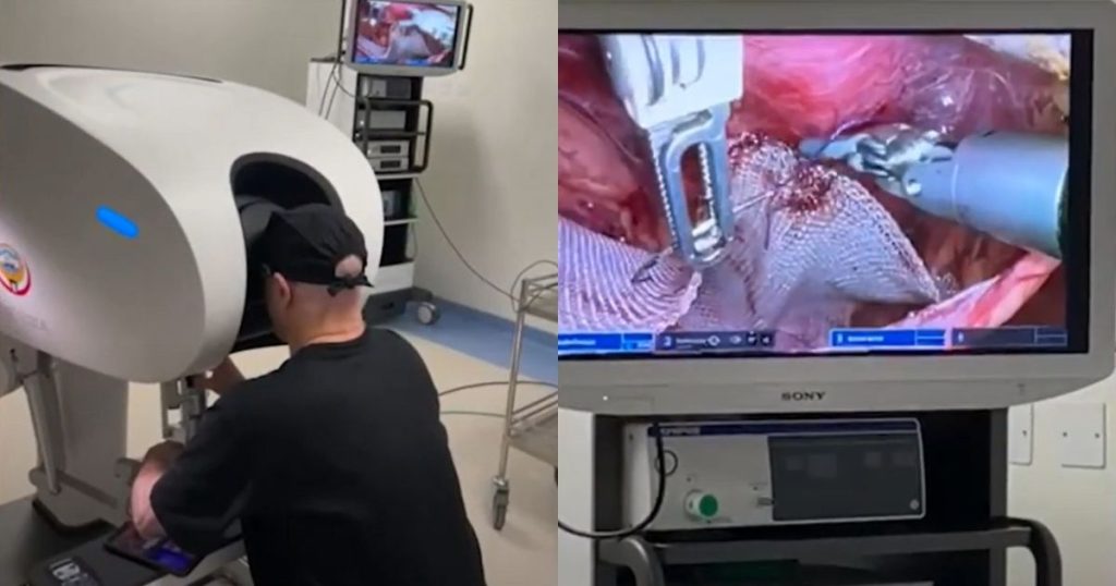 Hospital paranaense bate recorde e realiza a maior cirurgia à distância do mundo