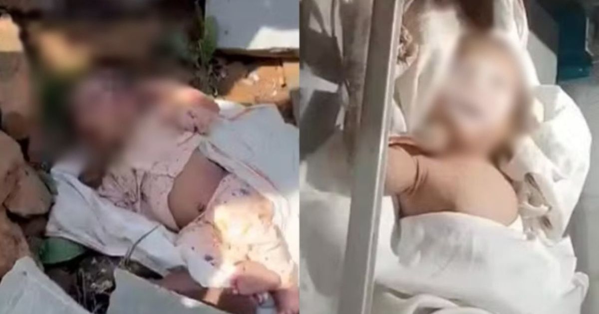 Recém-nascido é abandonado em matagal com pedra na boca e lábios colados
