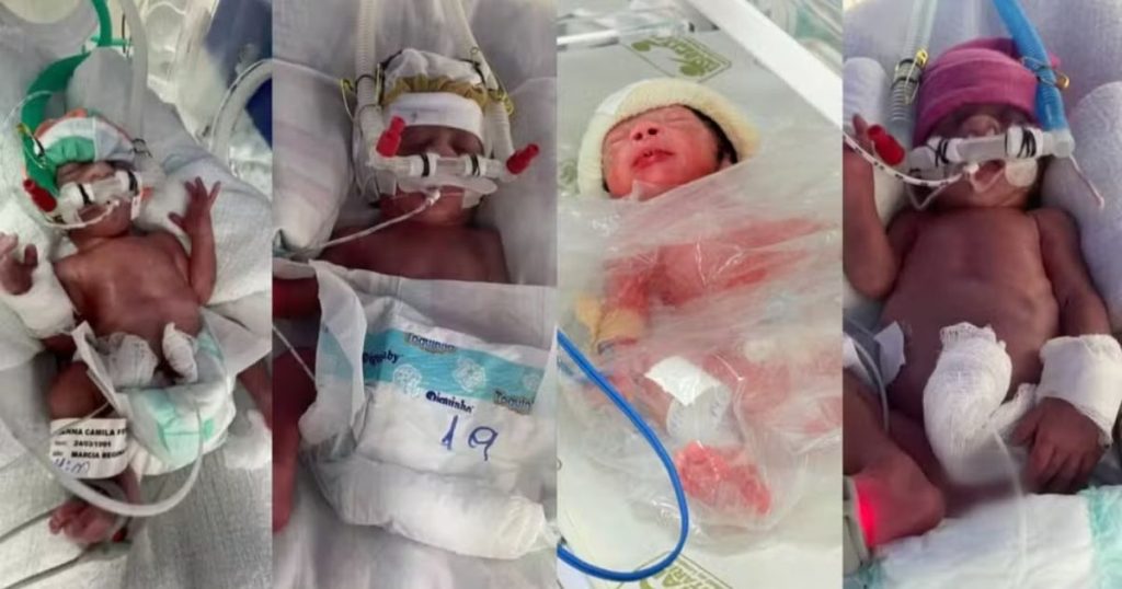 Quadrigêmeos no Paraná: divisão de embrião fez com que só um irmão não seja idêntico; entenda