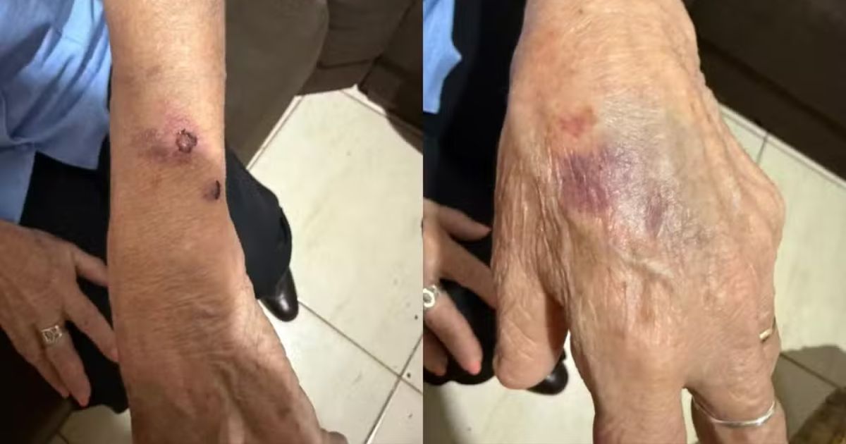 Idosa é resgatada após vizinha ouvir gritos e denunciar filha por cárcere e agressões no PR